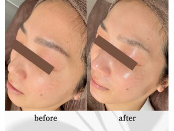 アン ビューティー(ann beauty)/リピーター様 30代女性