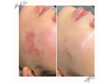 大分初導入☆韓国皮膚専門機関が愛用HISTOLAB韓国肌管理が大分で