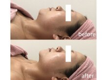 サーナステラ(Sana Stella)/『小顔になりたい』あなたへ