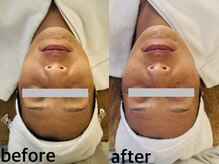 メナードフェイシャルサロン 西五反田/小顔/トーンUP/ハリ・ツヤ