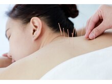 ほぐせる スター鍼灸接骨整体院 竹ノ塚 竹ノ塚東口駅前店/鍼45分コース8900円→8500円