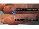 GWも対応！巻き爪の痛み改善
