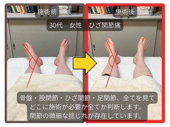 まこと整骨院/膝や股関節に痛みのある方