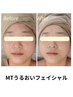 【乾燥で肌がゆらぎやすい方に】MTうるおいフェイシャル
