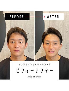 東京デトックス/インディバフェイシャル