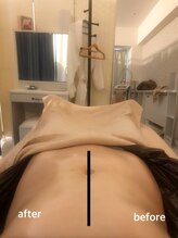 スキニー 六本木店(Skinnie)/お腹片側10分施術