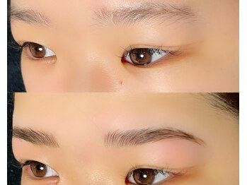 ヴィータ(VITA)/ハリウッドブロウリフト