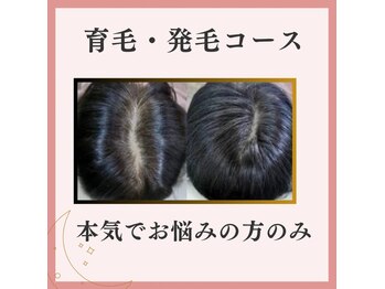 ルナイーズ(Luna Ease)