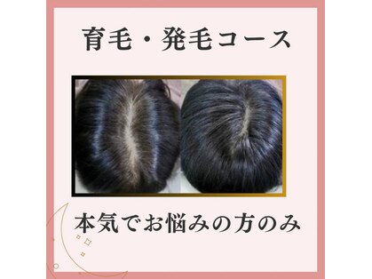 ルナイーズ(Luna Ease)の写真