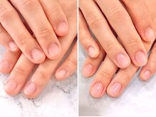 リファーレ(RIFARE)/【深爪矯正】丸いお爪から大変身