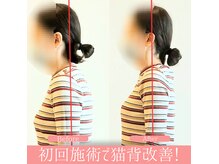 アンドピースセラピー(& P's Therapy)の雰囲気（猫背・巻き肩やスマホっ首の改善はお任せください！）