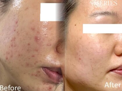 メルシートータルビューティー(MERCI)の写真