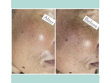 リノ(Lino)の雰囲気(プラズマニア♪40代からのお肌ケアにピッタリマシーン♪)