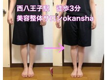 美容整体サロン オオカンシャ(okansha)/O脚Before→after