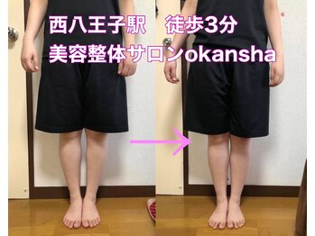 美容整体サロン オオカンシャ(okansha)/O脚Before→after