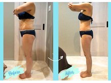 千歳の女神 三河安城店/【施術風景】Before/After