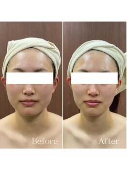 メイス 福井店(MEIS)/お客様Before、After