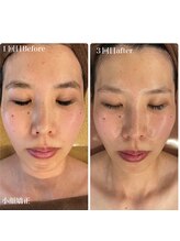 オレアグリーン 岡崎(OLEA green)/小顔×肌管理