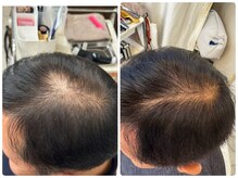 大人気！幹細胞ケアで一気に時を戻す！