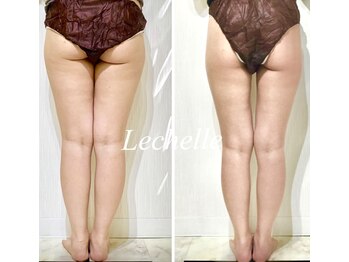 レシェルサロン(Lechelle Salon)/ハイパーナイフBODY