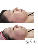 シェルリ 用賀(Shellri)/