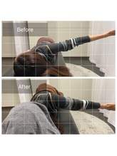 ナオル整体 浅草院(NAORU整体)/20代女性【巻き肩矯正】