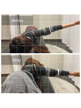 ナオル整体 浅草院(NAORU整体)/20代女性【巻き肩矯正】