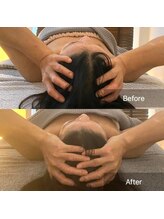 サロンツキ(salon tuki)/【癒しのヘッドスパ】症例