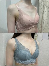 バーディー(BIRDIE)/施術1年/20代/AAA→B