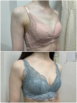 バーディー(BIRDIE)/施術1年/20代/AAA→B