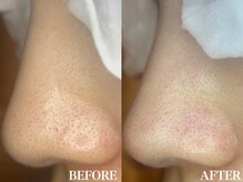 サロン ムスブ(salon MUSUBU)/山梨エステ/甲府エステ