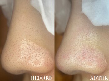 サロン ムスブ(salon MUSUBU)/山梨エステ/甲府エステ