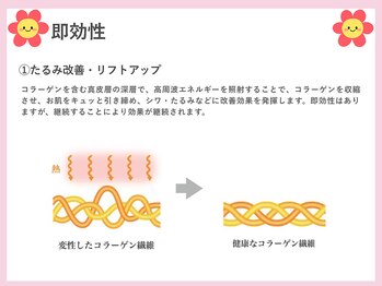 ラディアント たまプラーザ/即効性