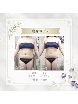 アディッシモ(addissimo)/脂肪冷却＋ボディでお腹スッキリ