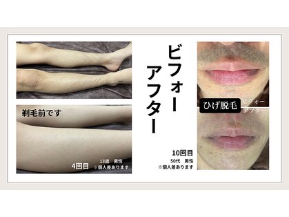 ブランコ バイ ボンド(BLANCO By BOND)の写真