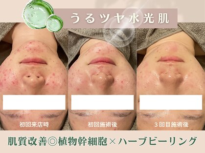 ルプレ(Lupure)の写真