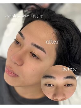 シツ(SHITSU)/症例【before・after】眉毛Wax