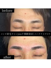 ユー 千葉駅前店(you)/ビフォ－アフター写真