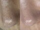 サロン ド クラルテ(salon de clarte)の写真/なかなか改善しない毛穴悩みを根本改善★クリスティーナ5種正規取扱◎