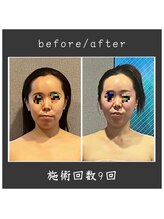 サロン ド ハーモニー美/コルギ♪非対称・小顔等