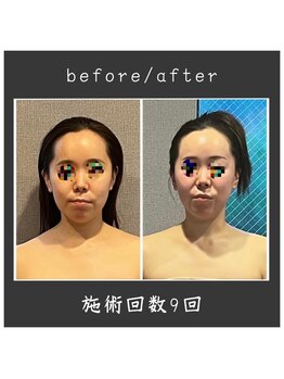 サロン ド ハーモニー美/コルギ♪非対称・小顔等