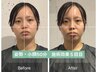 【変化No.1:歪み改善】目の高さ&左右差+骨盤矯正+小顔矯正¥15,900→¥3,500