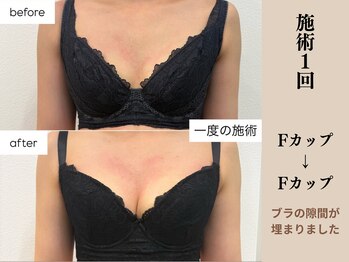 ソワ(soie)/憧れの谷間