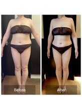 ウノジェンネ UNO DJENNE/たった3ヶ月で－8.0kg痩身!!50代