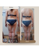 プライベートエステ カモミール/ハイパーマジック120全身痩身