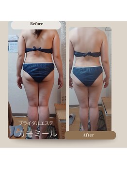 プライベートエステ カモミール/ハイパーマジック120全身痩身