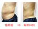 東京美容整体の写真/品川駅徒歩3分★春夏に気になるぽっこりお腹に！皮下脂肪分解×代謝アップで引き締まった体へ