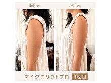 メルティーズ 東京 麻布十番(MELTY's)の雰囲気（脂肪に直撃!マイクロ波で小顔と華奢二の腕が同時に叶う）
