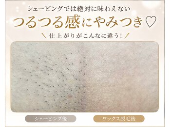 サクラ(SAKURA)の写真/"もっと早くやればよかった施術No.1" 当店大人気！【ブラジリアンワックス＋光脱毛のVIOダブル脱毛】
