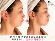 アユスリム(AYU SLIM)の雰囲気（首肩から整える小顔コルギ◎むくみ・たるみ・二重あごケア★小顔）